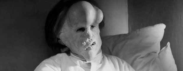 the elephant man tp