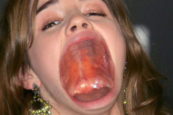 actresseswithoutteeth.net
