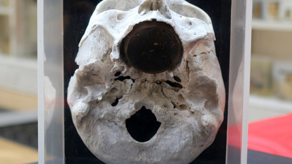 buzz lightyear x ray