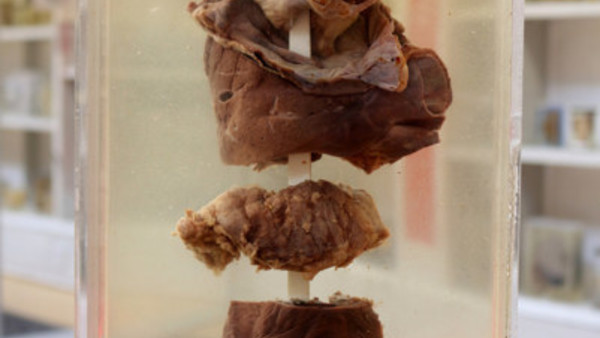 buzz lightyear x ray