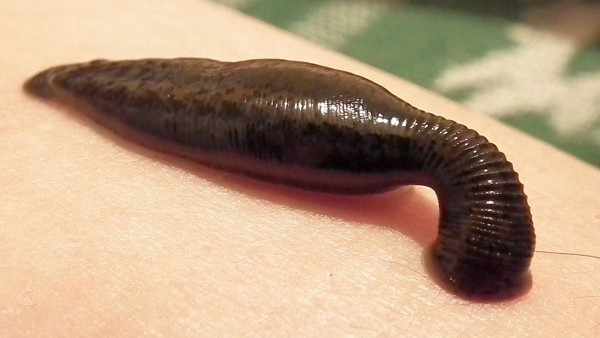 leech sucking