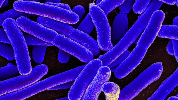 e coli bacteria