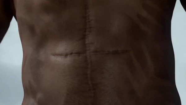 Death Stranding birth scar cesarian