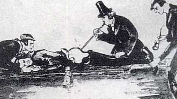 smoke enema