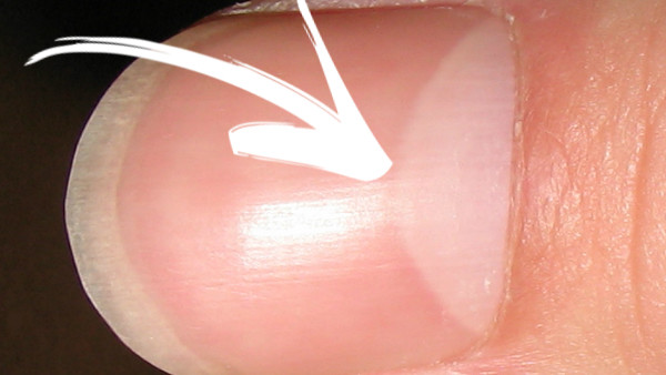 Nail lunula
