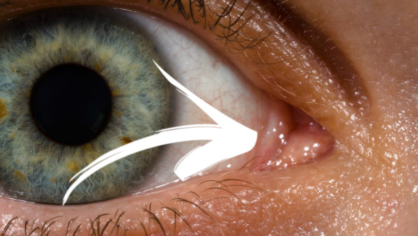 Eyes tear duct