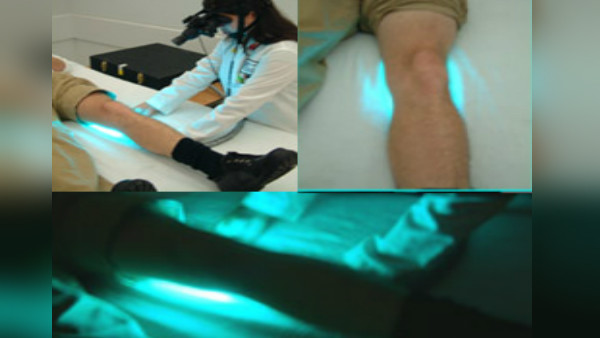 Light Knees