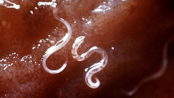 Hookworms In Gut