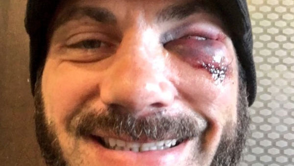 AUSTIN ARIES