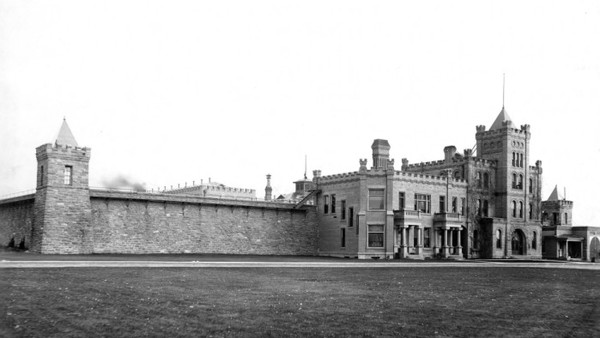 Canavero head transplant