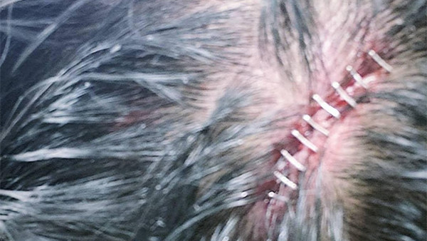 Mustafa Ali Wound