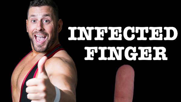 Colt Cabana Finger
