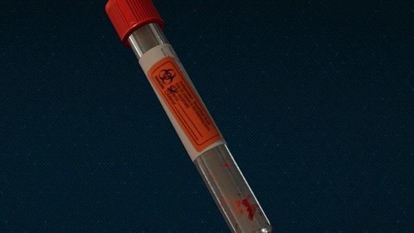 Spider-Man PS4 Lizard's Blood