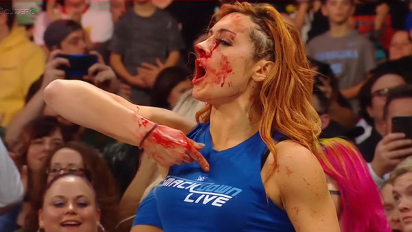 Becky Lynch Blood