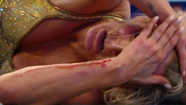Charlotte Blood WrestleMania 34