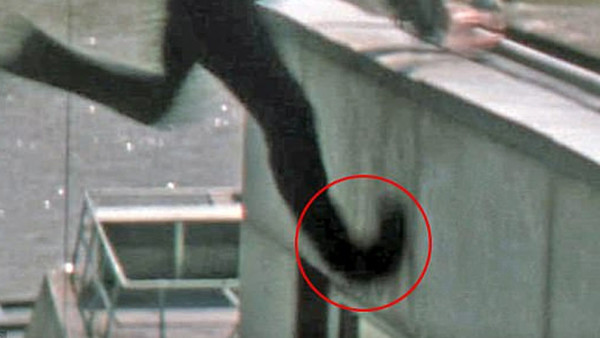 Tom Cruise Broken Ankle