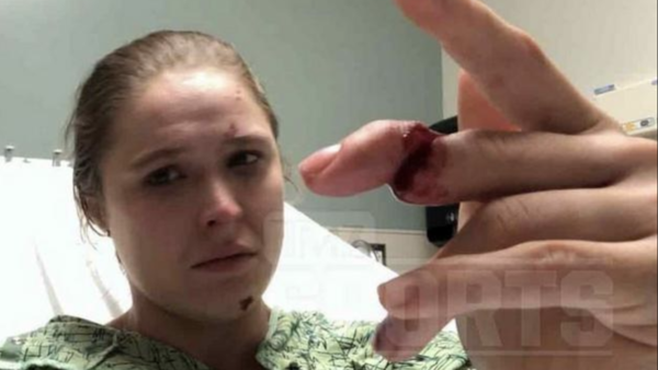 ronda rousey finger