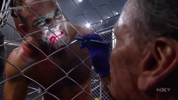 Timothy Thatcher bleeding