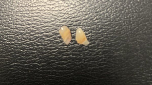 Kofi Kingston Teeth