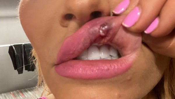 Natalya mouth