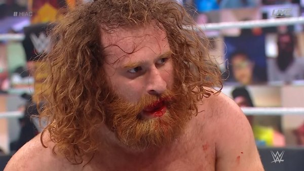 Sami Zayn Split Lip