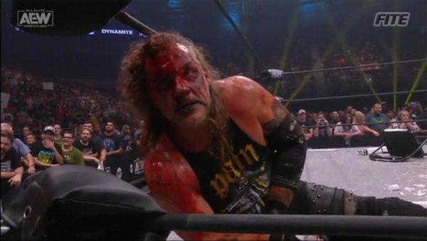 Chris Jericho Blood