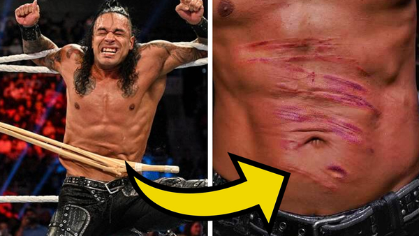 Damian Priest stomach